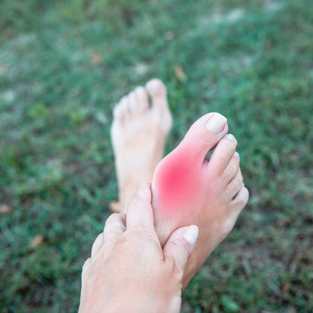 Minimally Invasive surgery patients recovery.